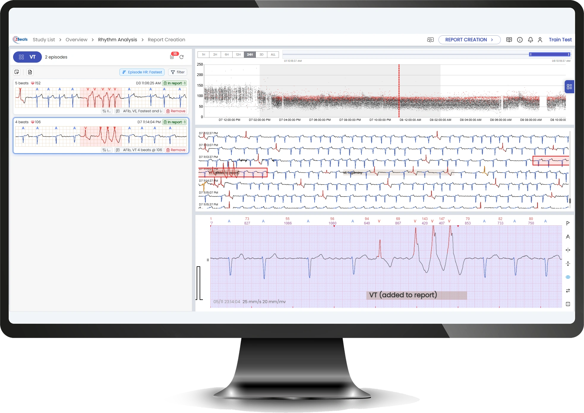 ZBPro Diagnostic v2.0 technician screen showing ECG episodes, heart rate trends, and an annotated review strip.