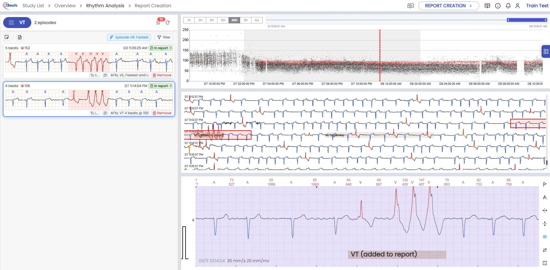 Diagnostic technician workspace with episode-level navigation, ECG context, and report-strip selection.
